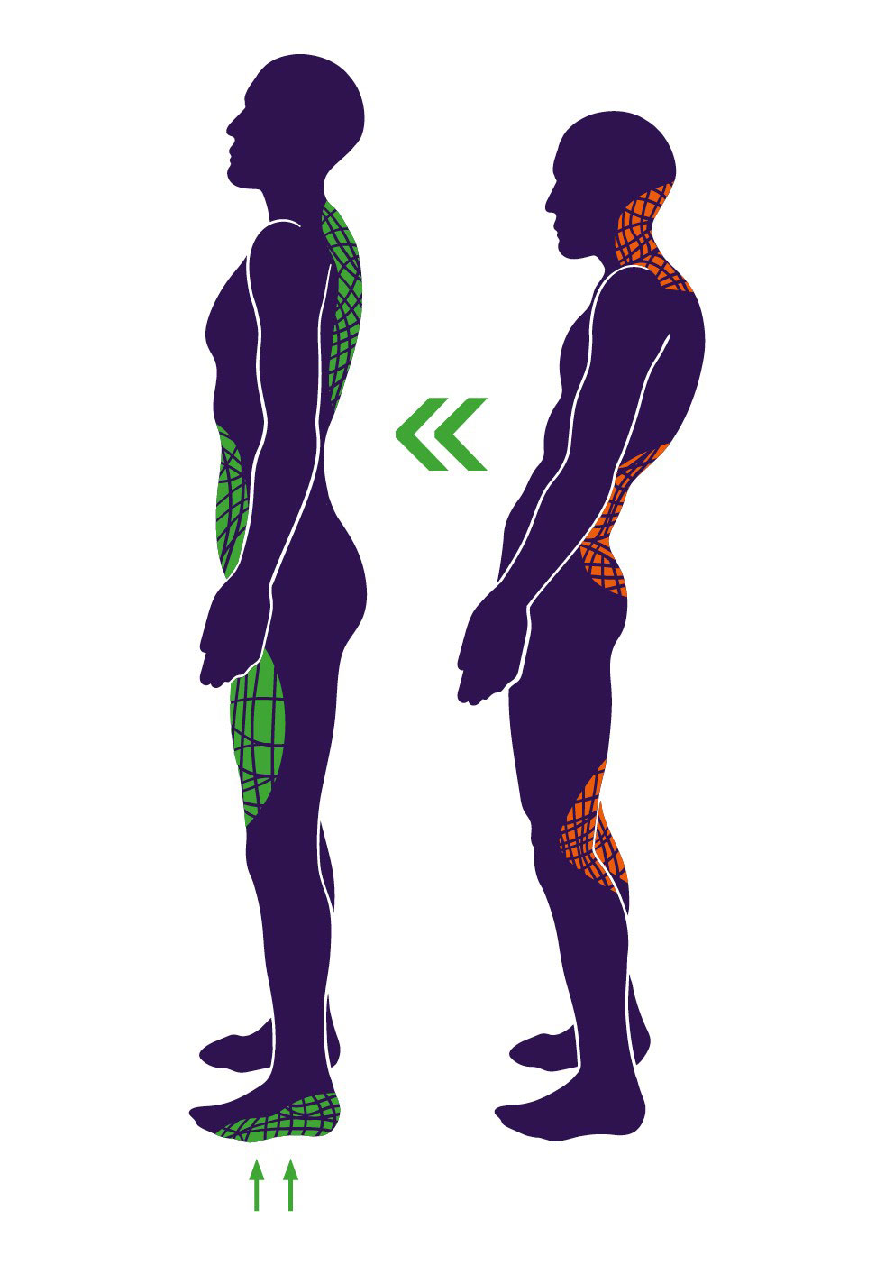 Körperhaltung bei Verspannung: falsche Haltung mit Nacken- und Rückenbeschwerden vs. aufrechte Haltung mit Entlastung.