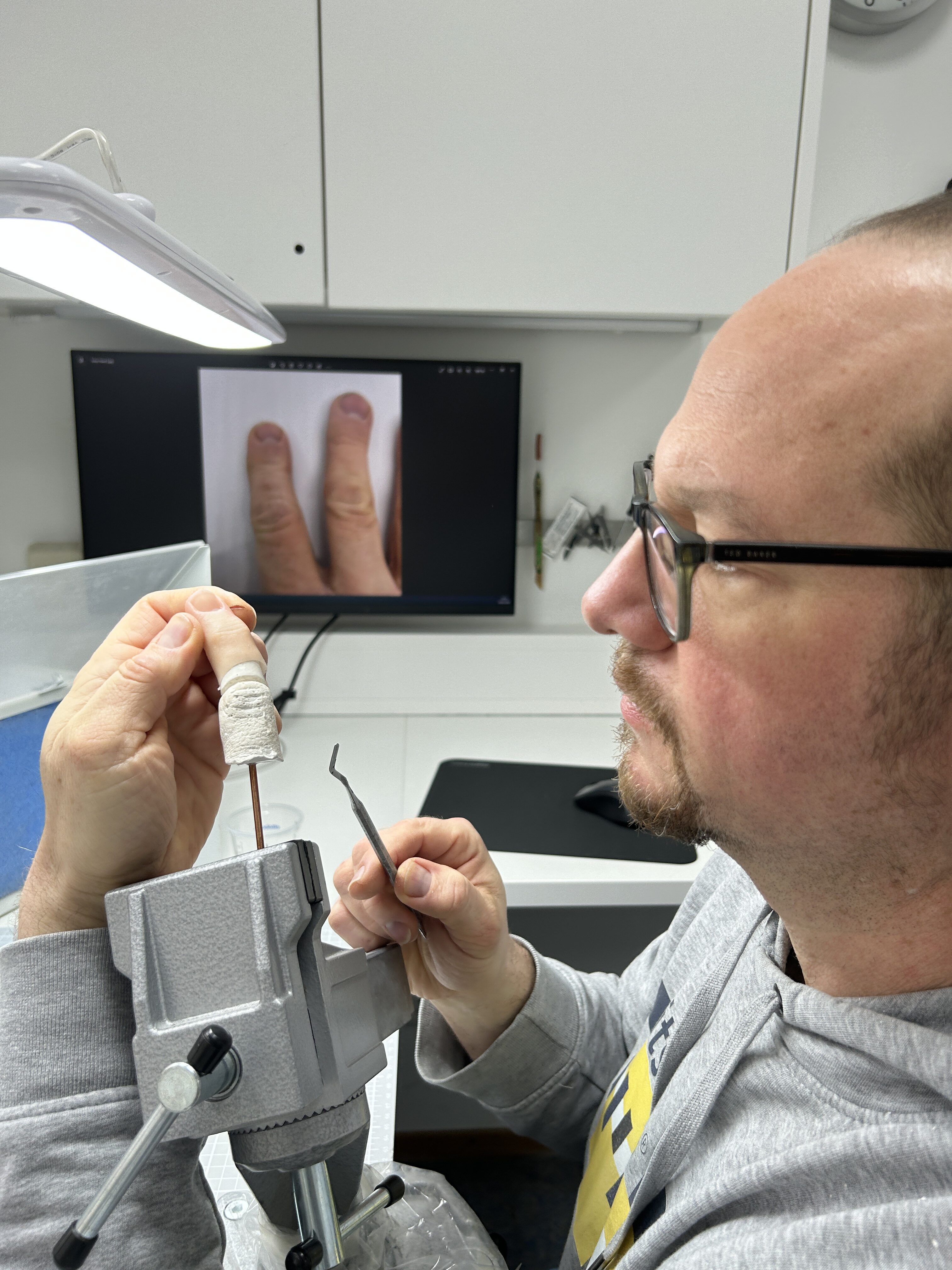 Orthopädietechnik-Mechaniker Tim bei seiner Arbeit mit Silikon.